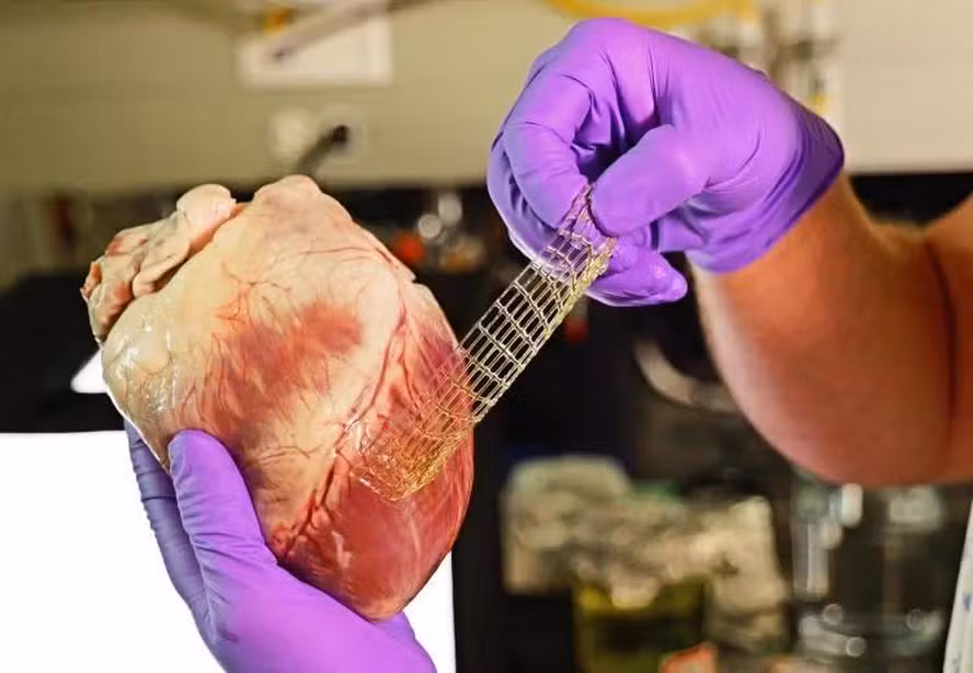 Band-aid cardíaco impresso em 3D pode reparar tecidos do coração