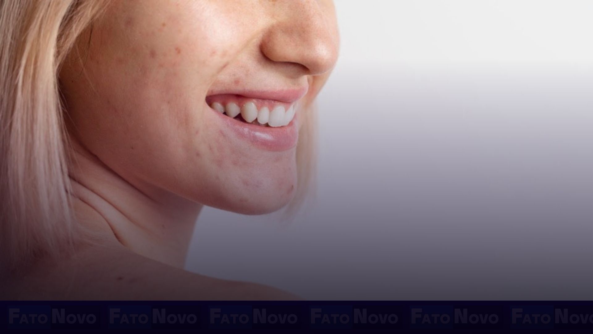 Entenda o motivo por trás de diabéticos terem a pele mais ressecada