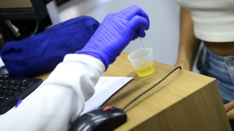 Rede pública de saúde oferece exame para diagnóstico precoce de complicações renais