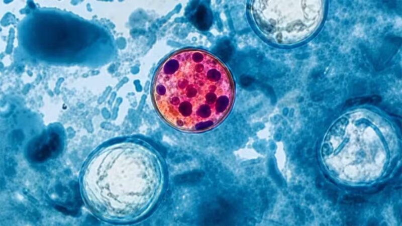 Ciclosporíase: o parasita da diarreia explosiva que preocupa