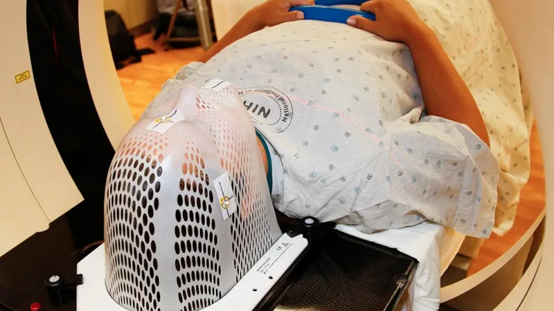 ChestFinder: software da UFF usa inteligência artificial para apontar enfisema e câncer de pulmão em tomografias