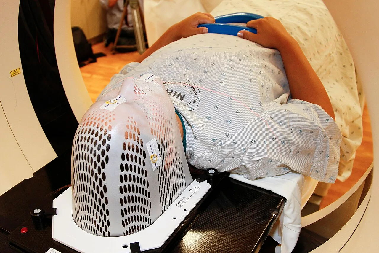 ChestFinder: software da UFF usa inteligência artificial para apontar enfisema e câncer de pulmão em tomografias