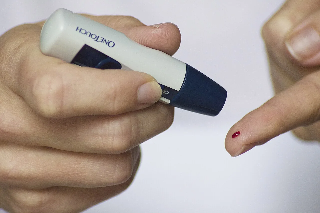 Diabetes tipo 5, ligado à desnutrição, passa a ser rastreado no Brasil a partir do Norte e Nordeste
