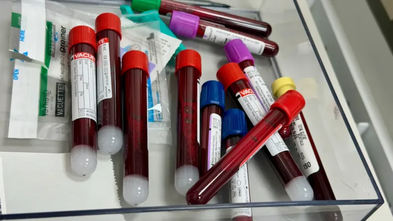 Exames de sangue de rotina: por que eles são aliados da prevenção