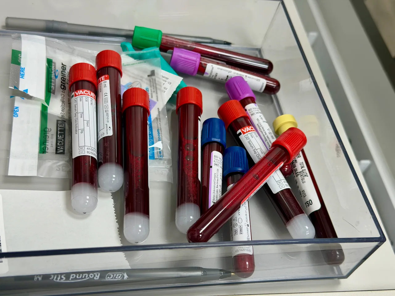 Exames de sangue de rotina: por que eles são aliados da prevenção