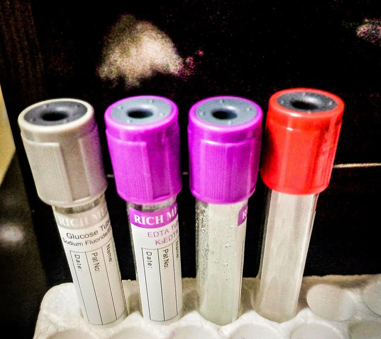 HTLV: teste no pré-natal é obrigatório na rede pública do DF para proteger os bebês