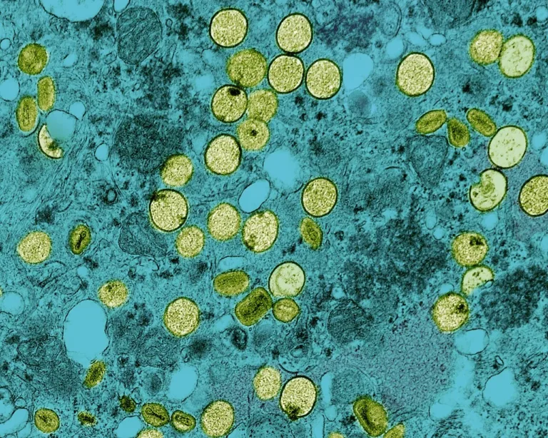 Ministério da Saúde confirma no Brasil primeiro caso da cepa Clade I da mpox