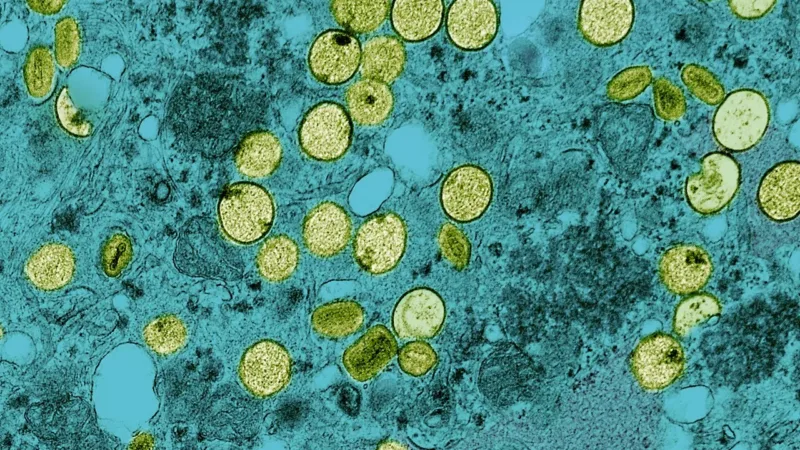 Ministério da Saúde confirma no Brasil primeiro caso da cepa Clade I da mpox