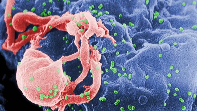 Paciente de Berlim fica mais de seis anos sem HIV detectável após transplante de células-tronco