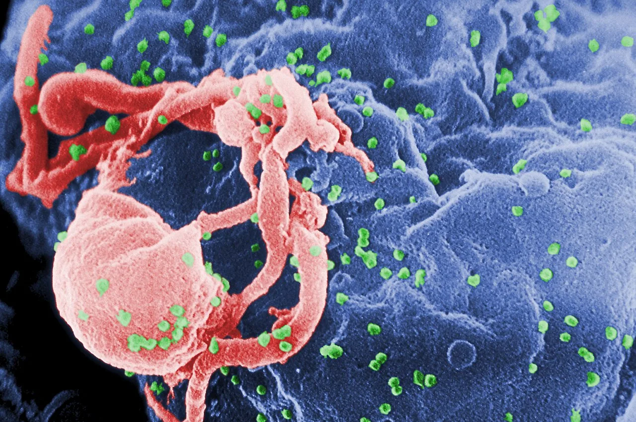 Paciente de Berlim fica mais de seis anos sem HIV detectável após transplante de células-tronco