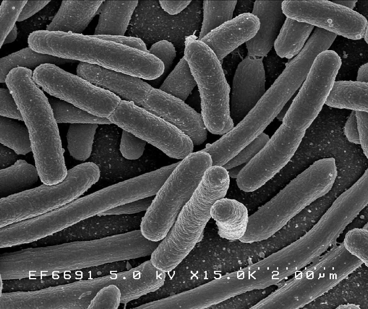 SIBO: entenda o excesso de bactérias no intestino delgado e como é tratado