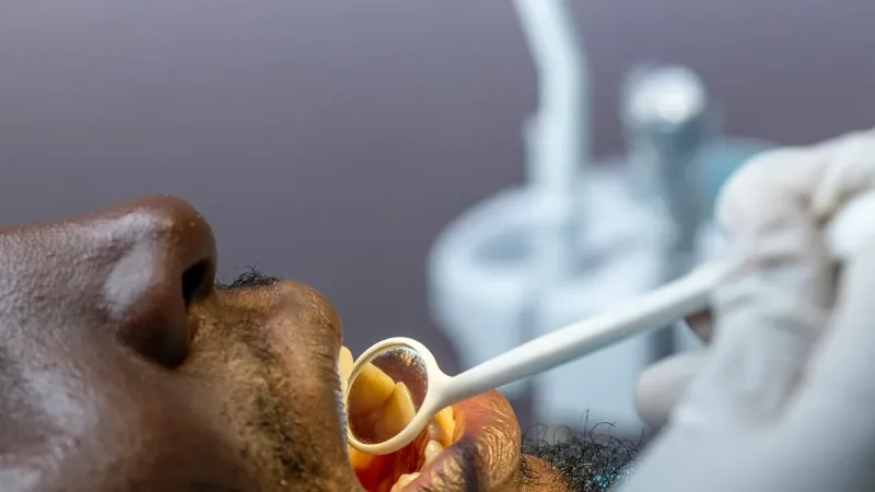 Tomar creatina em pó sem diluir pode desgastar o esmalte dos dentes