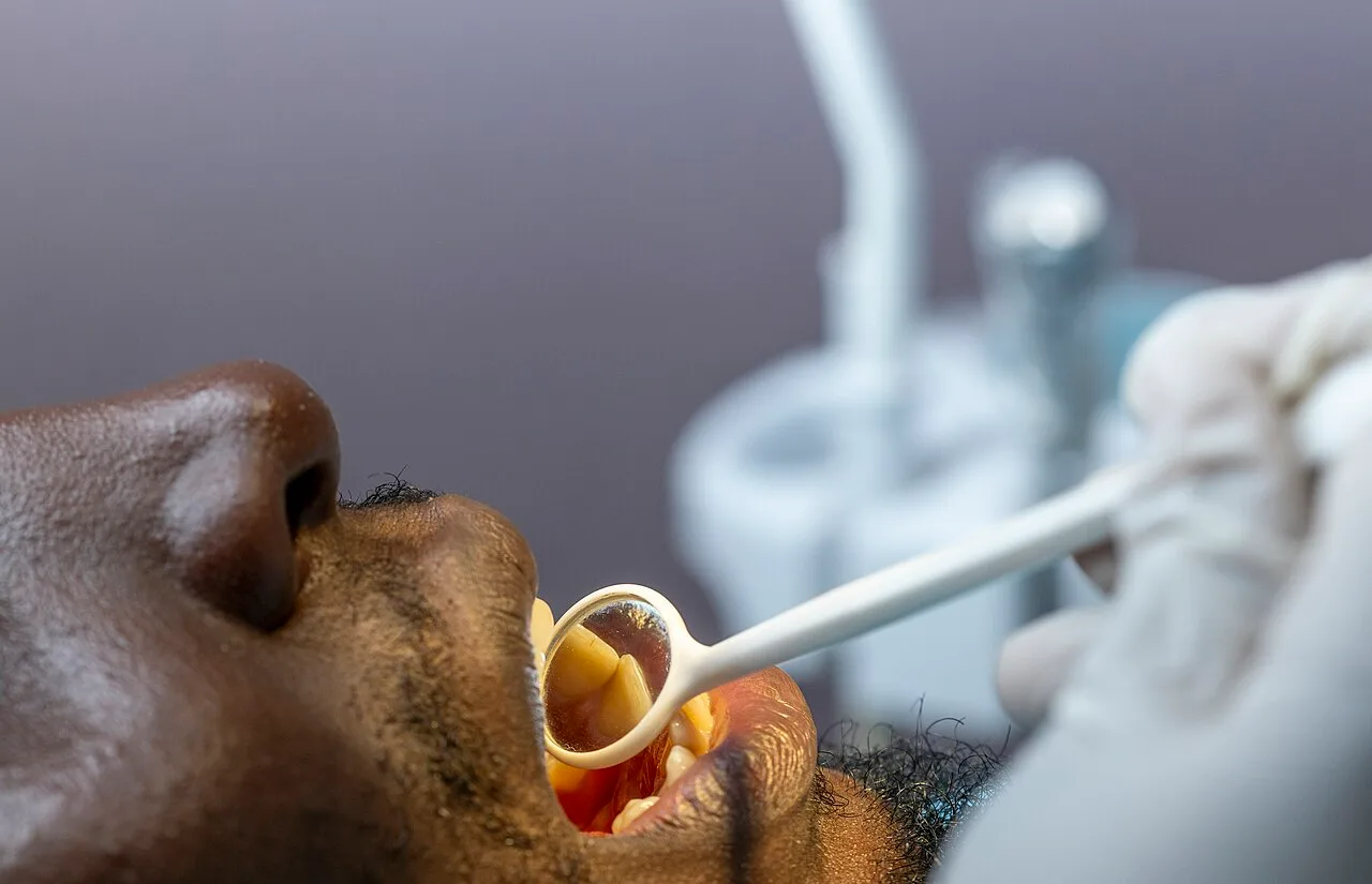 Tomar creatina em pó sem diluir pode desgastar o esmalte dos dentes